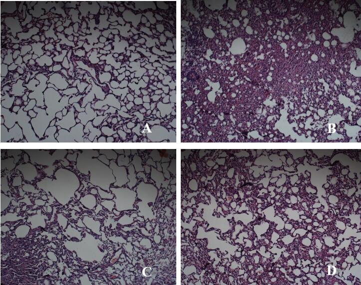 Effect of Buyang Huanwu Decoction on pathological morphology of lung tissue in rats with pulmonary fibrosis (x100)