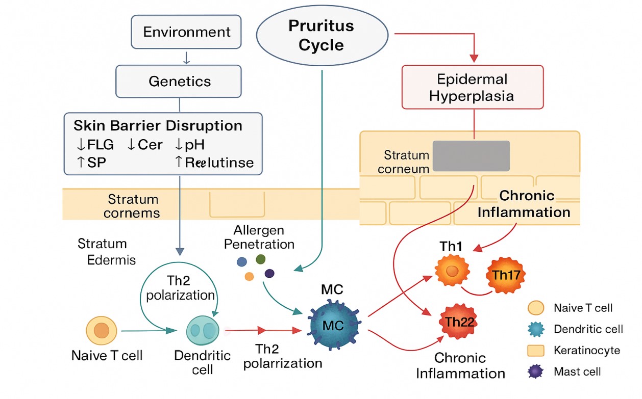 Skin barrier dysfunction and immune response in AD